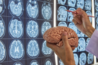 BrainPathJunction